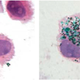 Tattoo pigment is released and recaptured by skin cells.